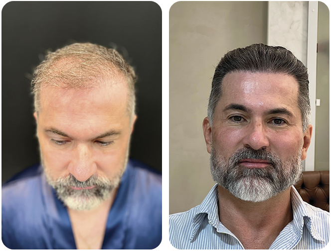 antes-depois2