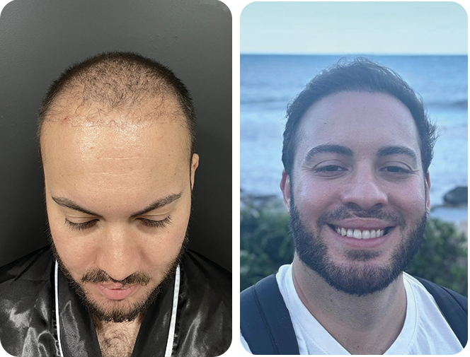 antes-depois4